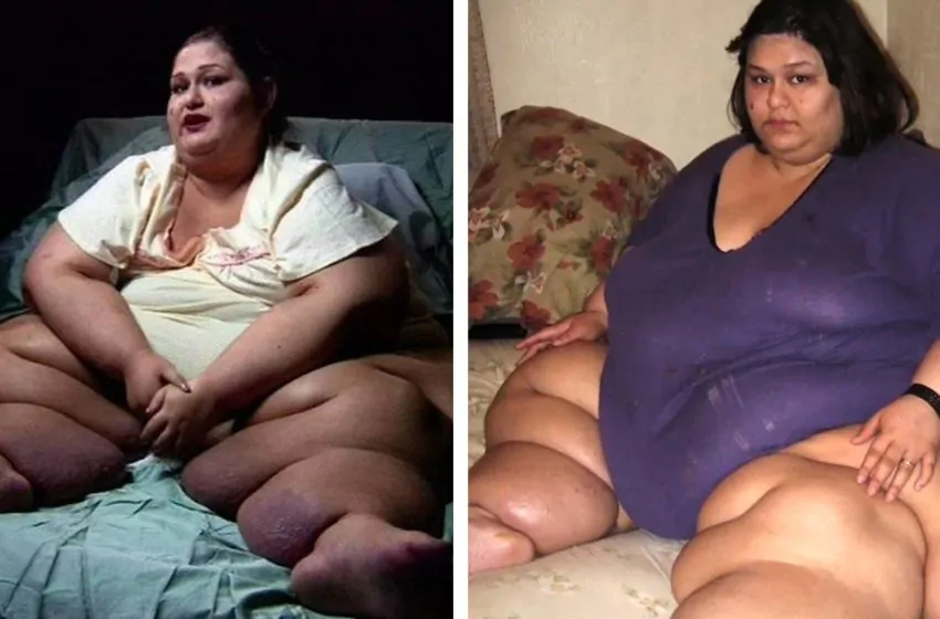 “Life after losing weight.” What the woman, who was deperate about her shape, looks like now